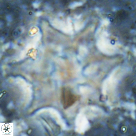 Discoaster falcatus 49437