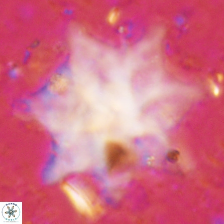 Discoaster falcatus 49440