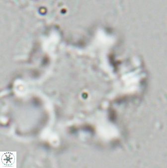 Discoaster soyhanii 26887