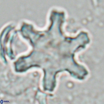 Discoaster fawzyi 26983