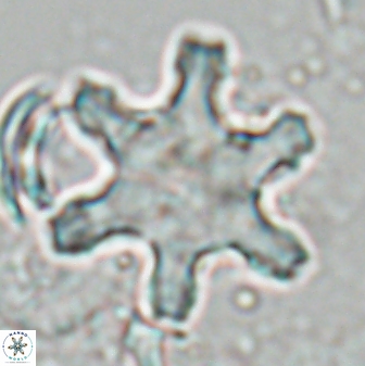 Discoaster fawzyi 26983