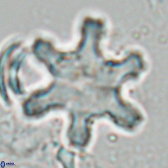 Discoaster fawzyi 26984