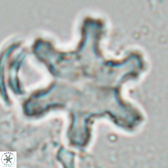 Discoaster fawzyi 26984