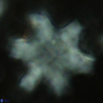 Discoaster soyhanii VR 17198