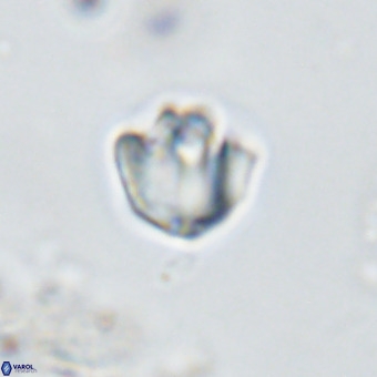 Discoaster gardiae VR 18639