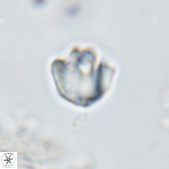 Discoaster gardiae VR 18639