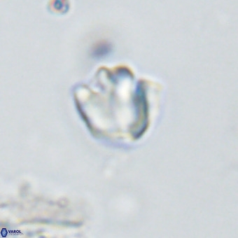 Discoaster gardiae VR 18627