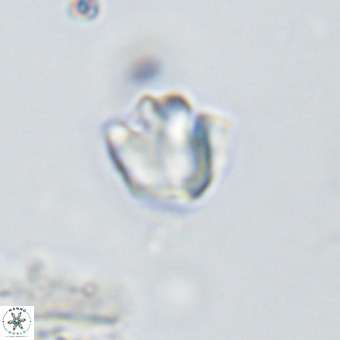 Discoaster gardiae VR 18627