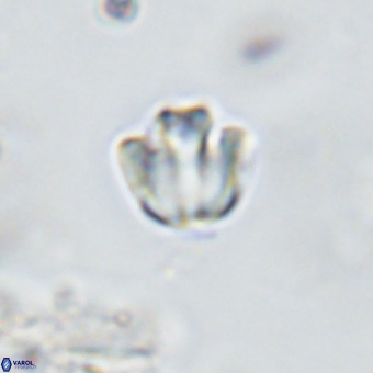 Discoaster gardiae VR 18628