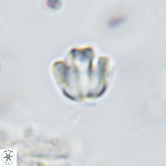 Discoaster gardiae VR 18628