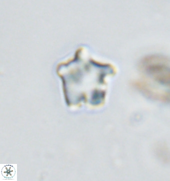 Discoaster gardiae VR 18632