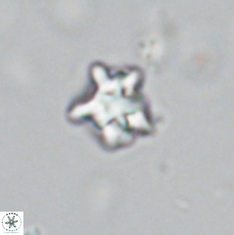 Discoaster gardiae VR 18636