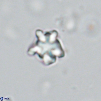 Discoaster gardiae VR 18641