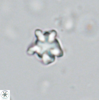 Discoaster gardiae VR 18639