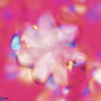 Discoaster geometricus 22668