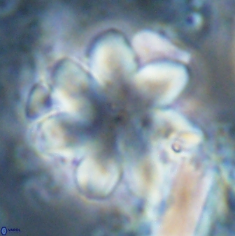Discoaster geometricus 22670