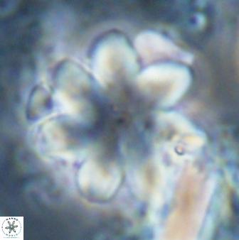Discoaster geometricus 22670