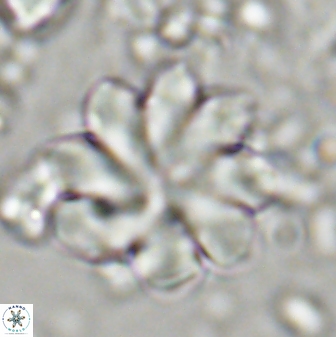 Discoaster geometricus 42938