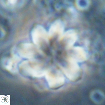 Discoaster geometricus 42940