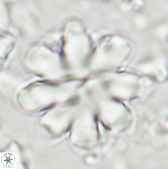 Discoaster geometricus 43689
