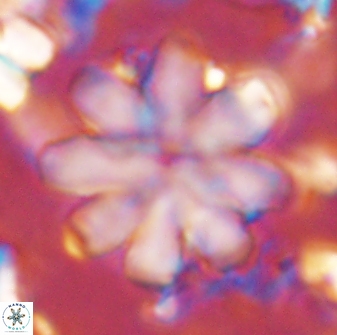 Discoaster geometricus 43693