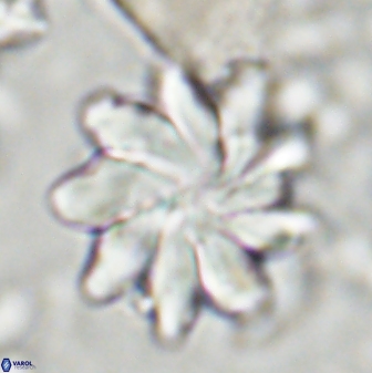 Discoaster gemmeus 43533