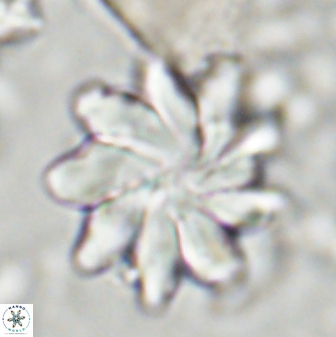 Discoaster gemmeus 43533