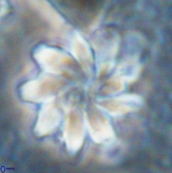Discoaster gemmeus 43534