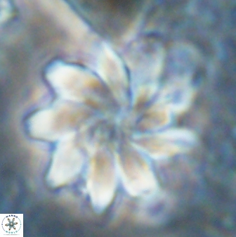 Discoaster gemmeus 43534