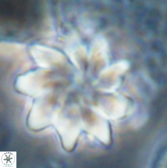 Discoaster gemmeus 43535