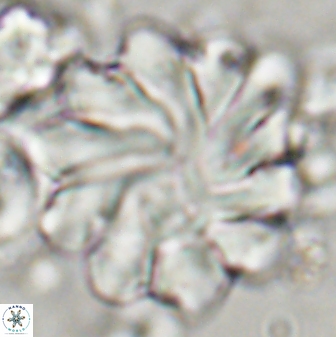 Discoaster gemmeus 45359