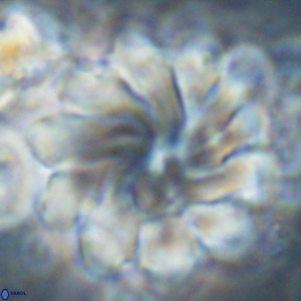 Discoaster gemmeus 45360