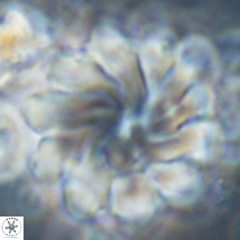 Discoaster gemmeus 45360