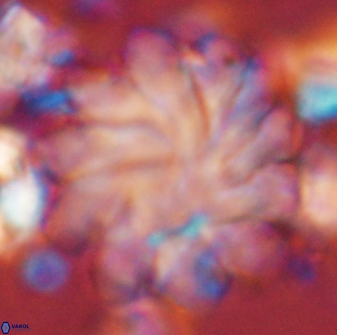 Discoaster gemmeus 45361