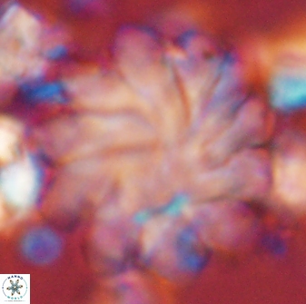 Discoaster gemmeus 45361