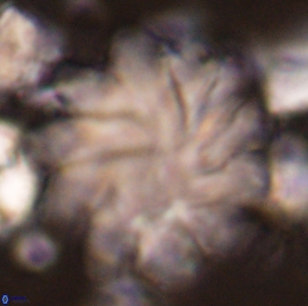 Discoaster gemmeus 45362