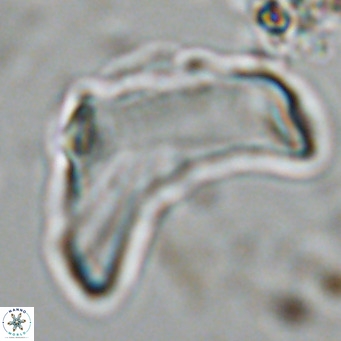 Discoaster giganteus VR 10459