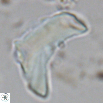Discoaster giganteus VR 10466