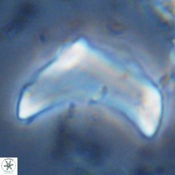 Discoaster giganteus VR 10474
