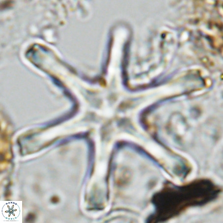 Discoaster giganteus VR 10420
