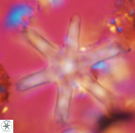 Discoaster giganteus VR 10425