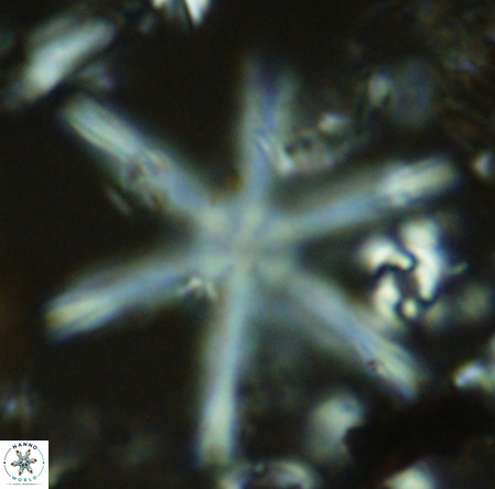 Discoaster giganteus VR 10430