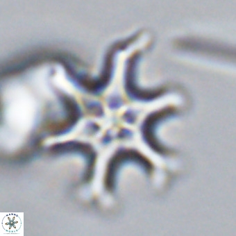 Discoaster hughesii VR 20142