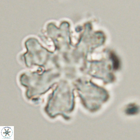 Discoaster heptabrachium VR 33173