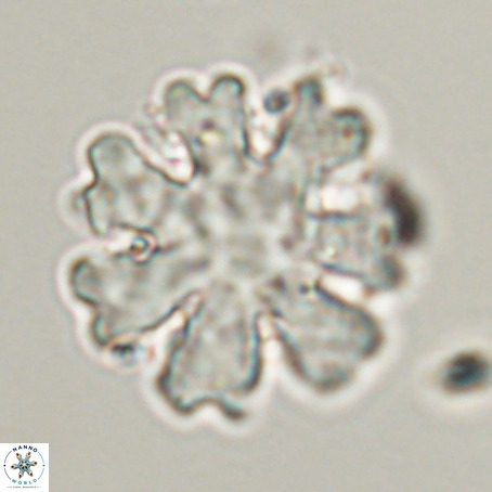 Discoaster heptabrachium VR 33175
