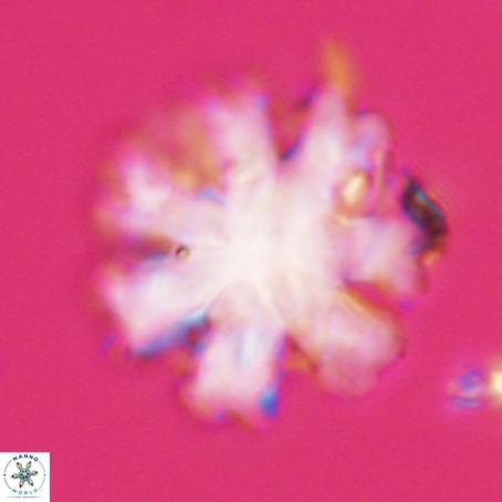 Discoaster heptabrachium VR 33180