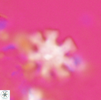 Discoaster heptanisogonius 27667