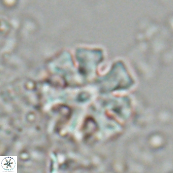 Discoaster heptanisogonius 27671