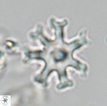 Discoaster heptanisogonius 28653