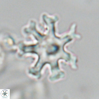 Discoaster heptanisogonius 28654